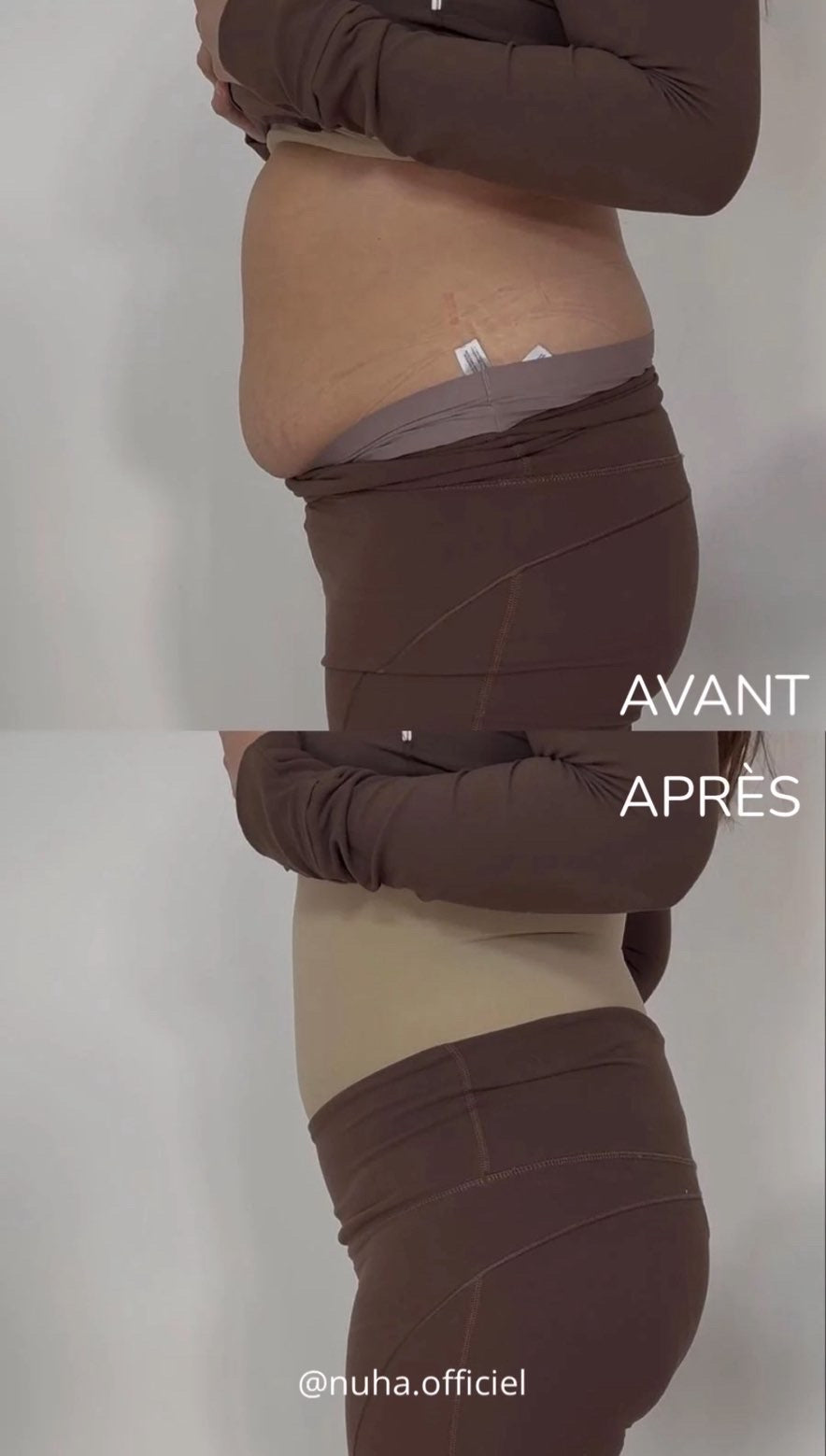 Fermeture à bouton-pression